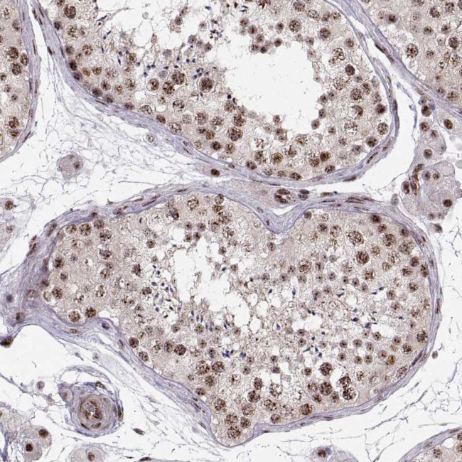 ZCCHC17 Antibody in Immunohistochemistry (Paraffin) (IHC (P))