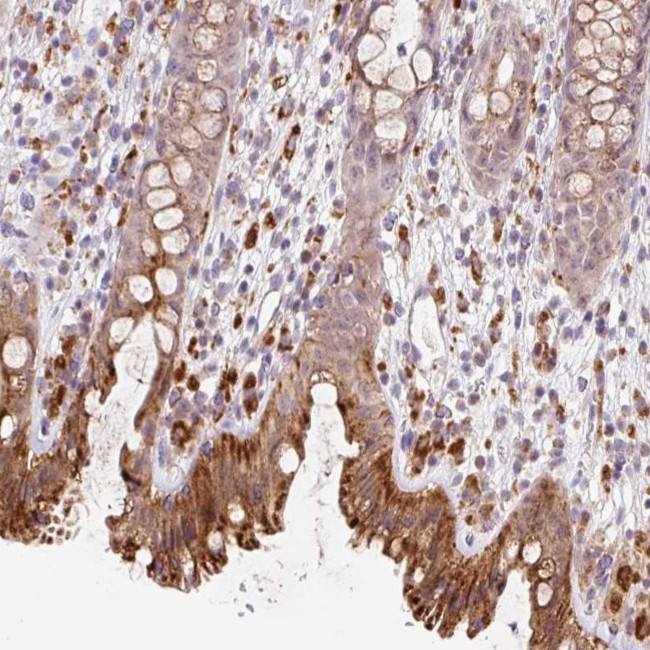 CEBPZOS Antibody in Immunohistochemistry (Paraffin) (IHC (P))