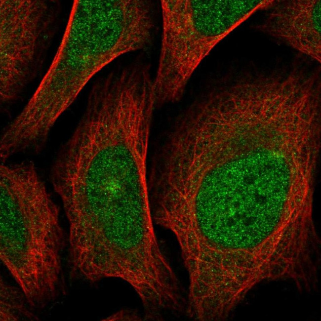 SCN4A Antibody in Immunocytochemistry (ICC/IF)