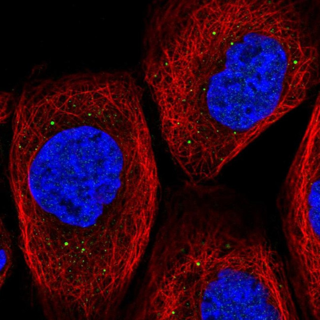 TIPRL Antibody in Immunocytochemistry (ICC/IF)