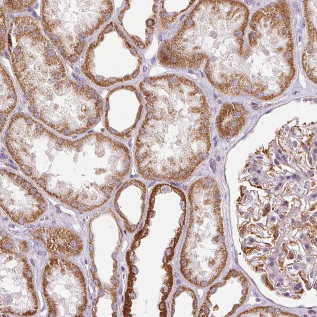 MRPL24 Antibody in Immunohistochemistry (Paraffin) (IHC (P))