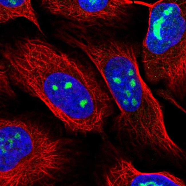 WDR3 Antibody in Immunocytochemistry (ICC/IF)