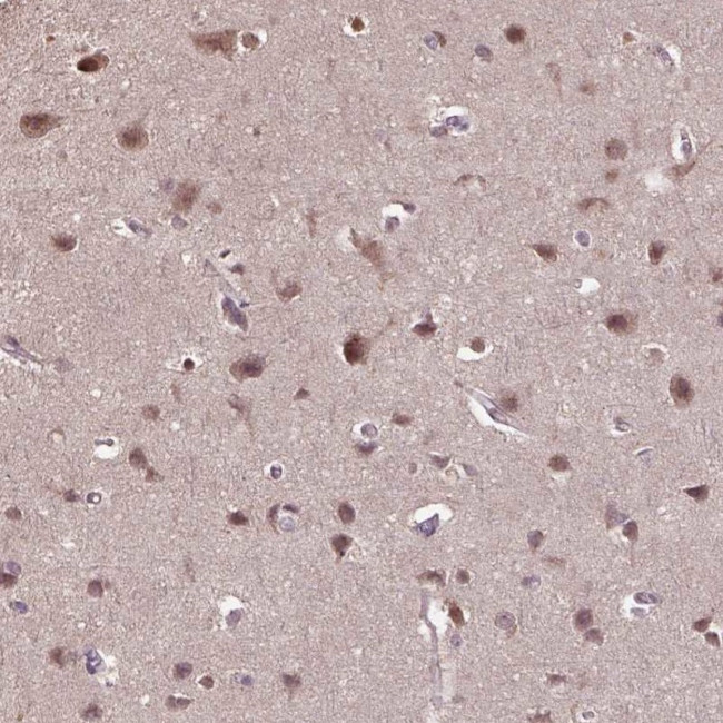 WDR17 Antibody in Immunohistochemistry (Paraffin) (IHC (P))