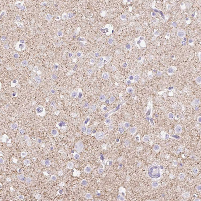 Orexin Receptor 2 Antibody in Immunohistochemistry (Paraffin) (IHC (P))