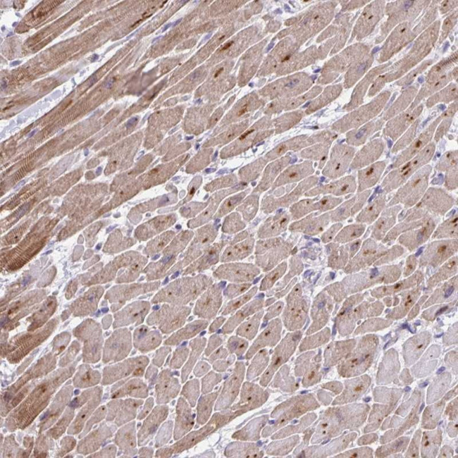 p38 MAPK gamma Antibody in Immunohistochemistry (Paraffin) (IHC (P))