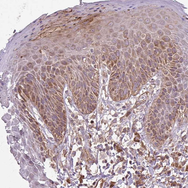 FLRT1 Antibody in Immunohistochemistry (Paraffin) (IHC (P))