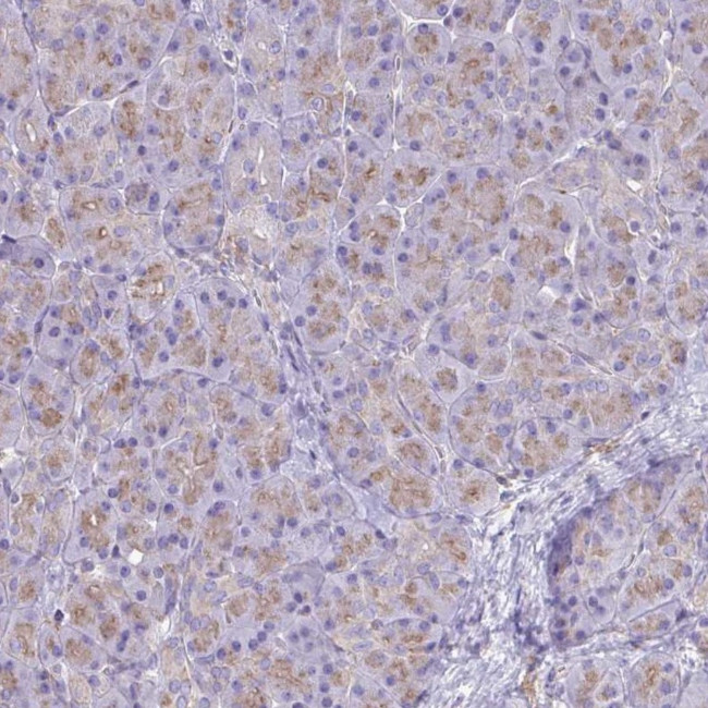 Clathrin Light Chain A Antibody in Immunohistochemistry (Paraffin) (IHC (P))
