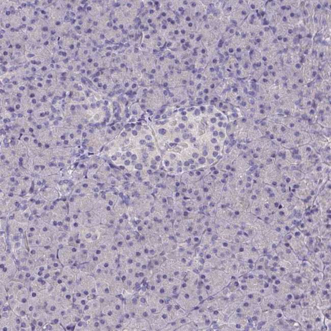 Talin 2 Antibody in Immunohistochemistry (Paraffin) (IHC (P))