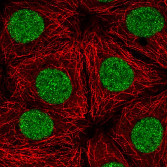 TTF1 Antibody in Immunocytochemistry (ICC/IF)