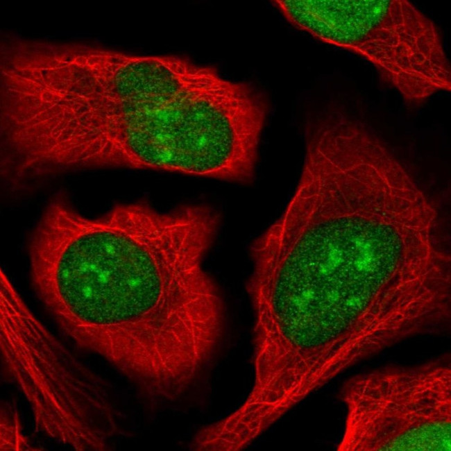 ZZZ3 Antibody in Immunocytochemistry (ICC/IF)