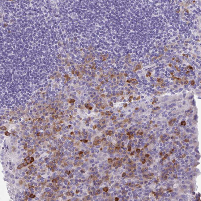 CD178 Antibody in Immunohistochemistry (Paraffin) (IHC (P))