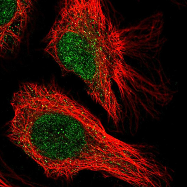 CENPQ Antibody in Immunocytochemistry (ICC/IF)