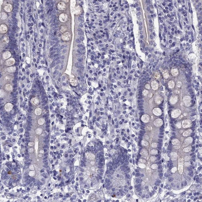 MYLPF Antibody in Immunohistochemistry (Paraffin) (IHC (P))