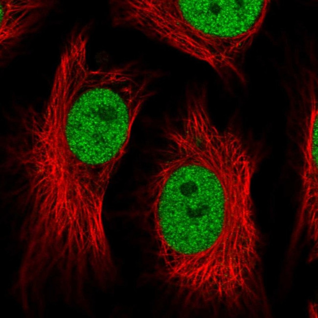ATF1 Antibody in Immunocytochemistry (ICC/IF)