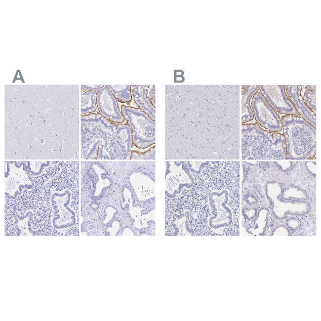 SGLT1 Antibody in Immunohistochemistry (Paraffin) (IHC (P))