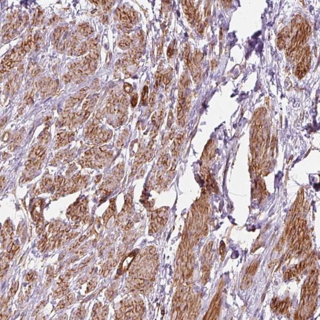 PRKCDBP Antibody in Immunohistochemistry (Paraffin) (IHC (P))