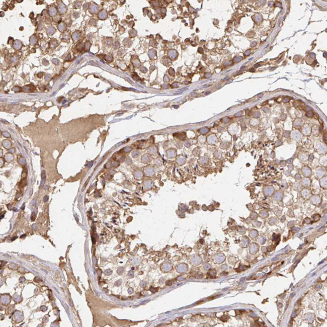 GRF-1 Antibody in Immunohistochemistry (Paraffin) (IHC (P))