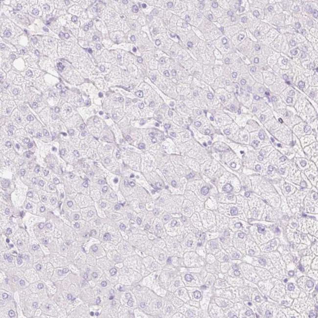 CDX1 Antibody in Immunohistochemistry (Paraffin) (IHC (P))