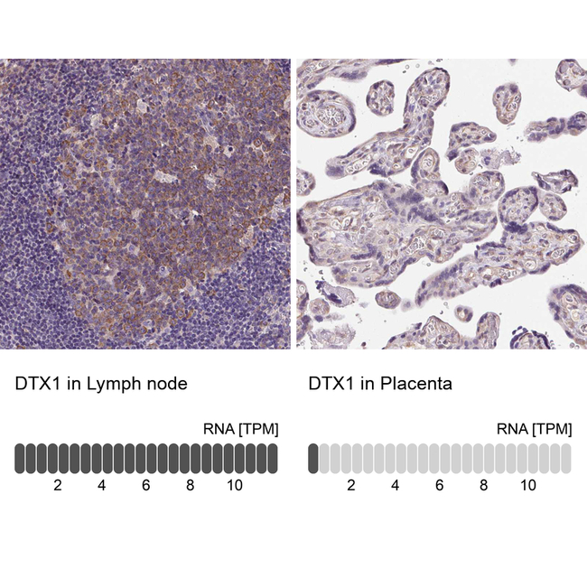 DTX1 Antibody in Immunohistochemistry (Paraffin) (IHC (P))