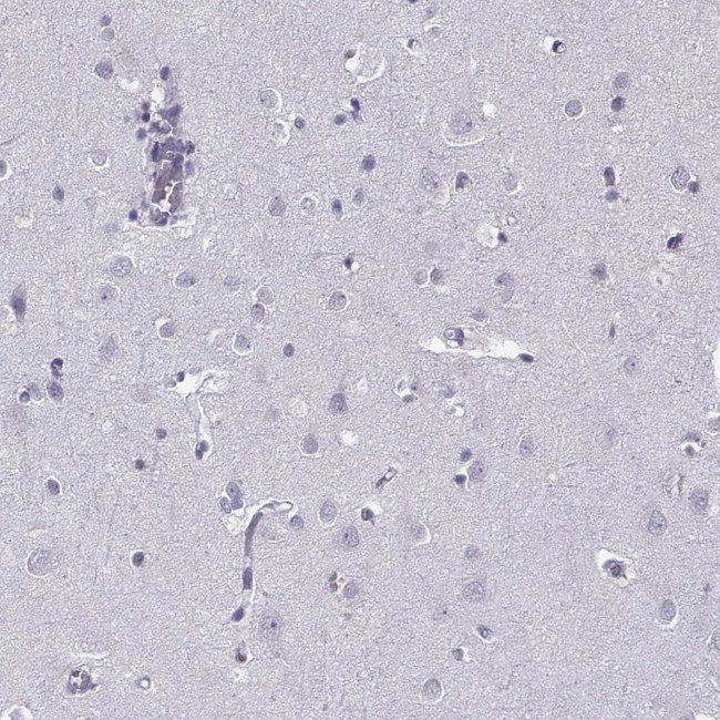 C16orf59 Antibody in Immunohistochemistry (Paraffin) (IHC (P))