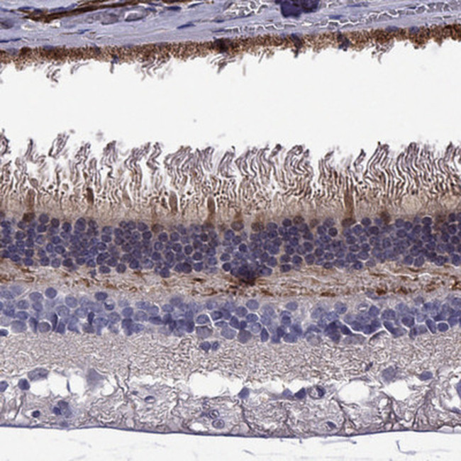 GCAP2 Antibody in Immunohistochemistry (Paraffin) (IHC (P))