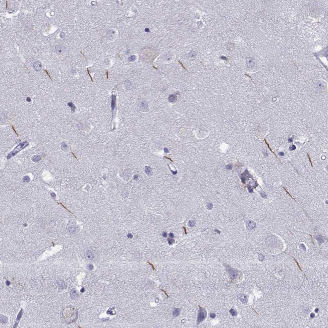 TRIM46 Antibody in Immunohistochemistry (Paraffin) (IHC (P))