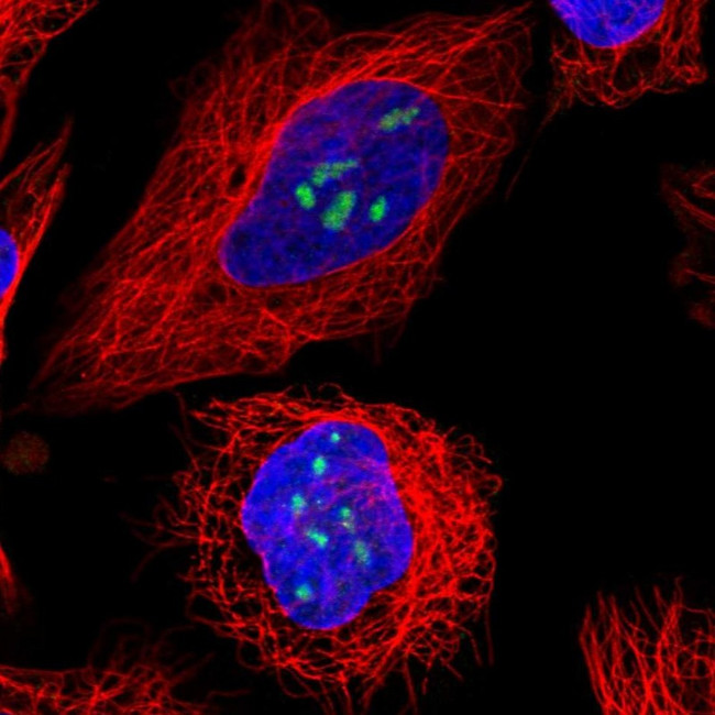 TBL3 Antibody in Immunocytochemistry (ICC/IF)