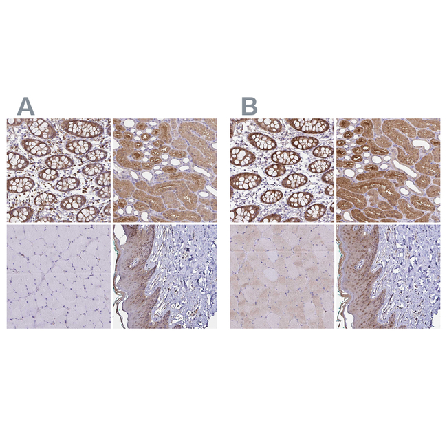 Thioredoxin 1 Antibody in Immunohistochemistry (Paraffin) (IHC (P))