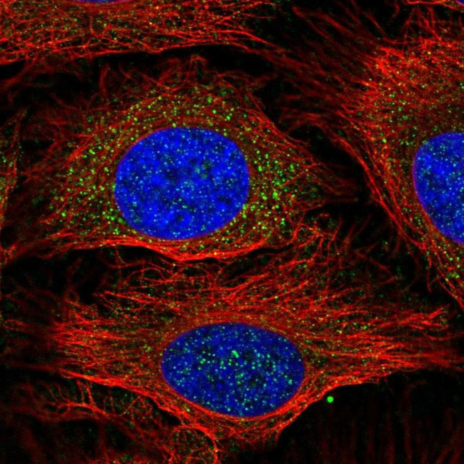 GSTM1 Antibody in Immunocytochemistry (ICC/IF)