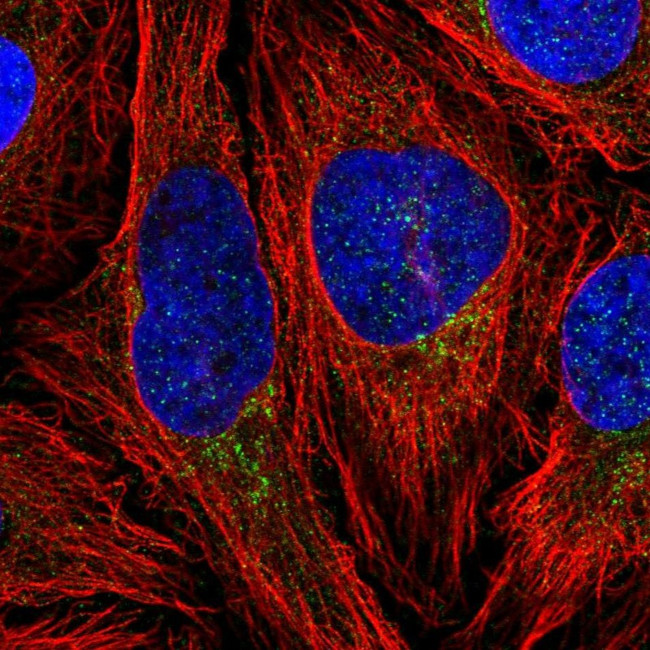 CLIP4 Antibody in Immunocytochemistry (ICC/IF)