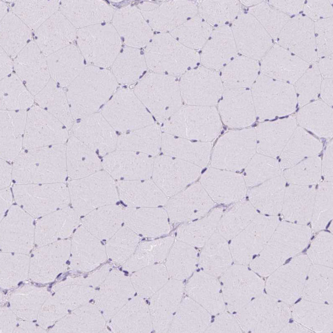 MINK1 Antibody in Immunohistochemistry (Paraffin) (IHC (P))