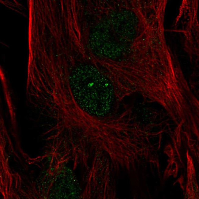FOXC2 Antibody in Immunocytochemistry (ICC/IF)