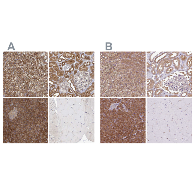 PACSIN2 Antibody in Immunohistochemistry (Paraffin) (IHC (P))