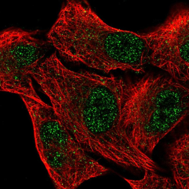 PHD1 Antibody in Immunocytochemistry (ICC/IF)