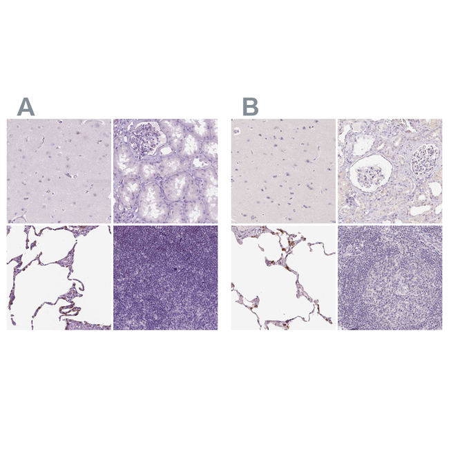 SFTPD Antibody in Immunohistochemistry (Paraffin) (IHC (P))