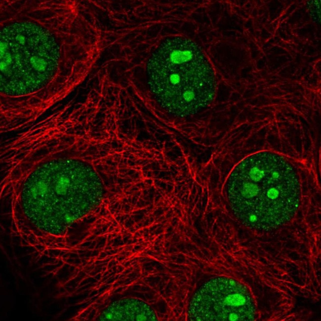 SH3TC1 Antibody in Immunocytochemistry (ICC/IF)