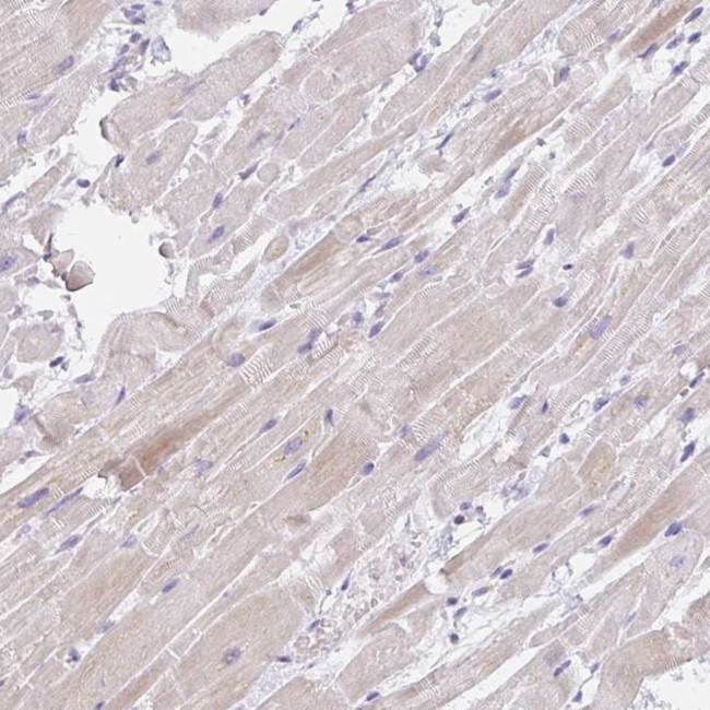 CaV1.1 Antibody in Immunohistochemistry (Paraffin) (IHC (P))