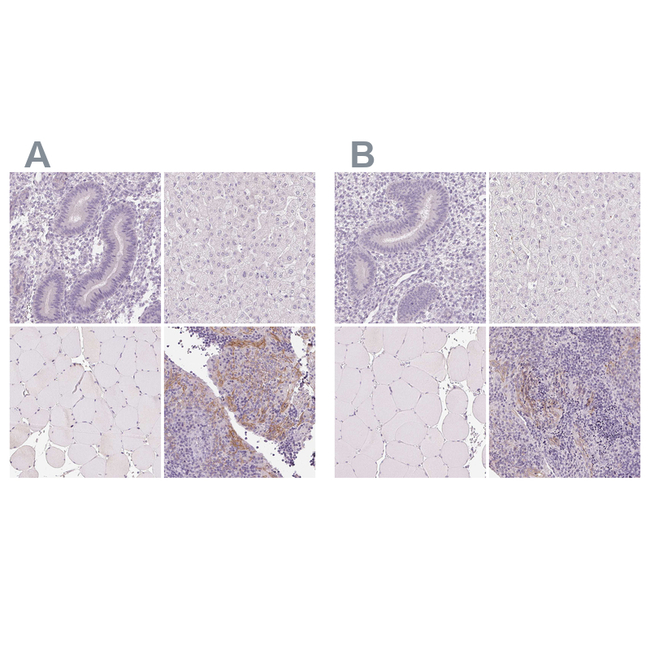 Desmoglein 3 Antibody in Immunohistochemistry (Paraffin) (IHC (P))