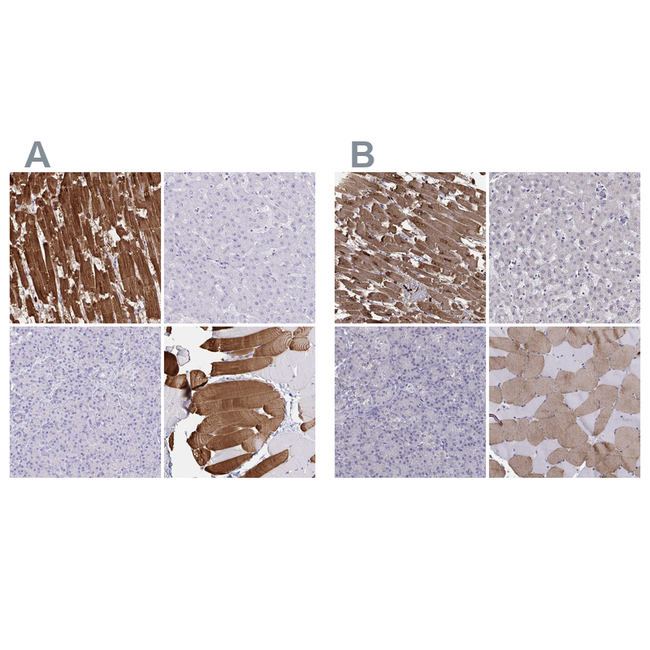 Cardiac Troponin C Antibody in Immunohistochemistry (Paraffin) (IHC (P))