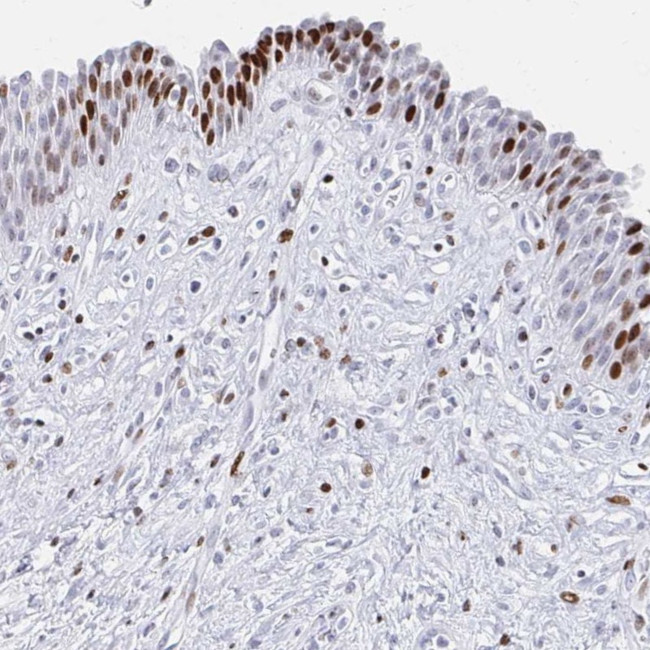 SRSF3 Antibody in Immunohistochemistry (Paraffin) (IHC (P))