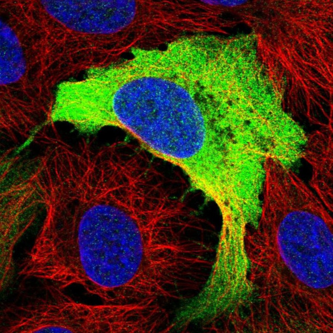 RRM2 Antibody in Immunocytochemistry (ICC/IF)