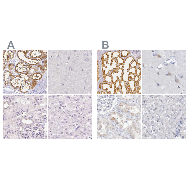 CSN1S1 Antibody in Immunohistochemistry (Paraffin) (IHC (P))