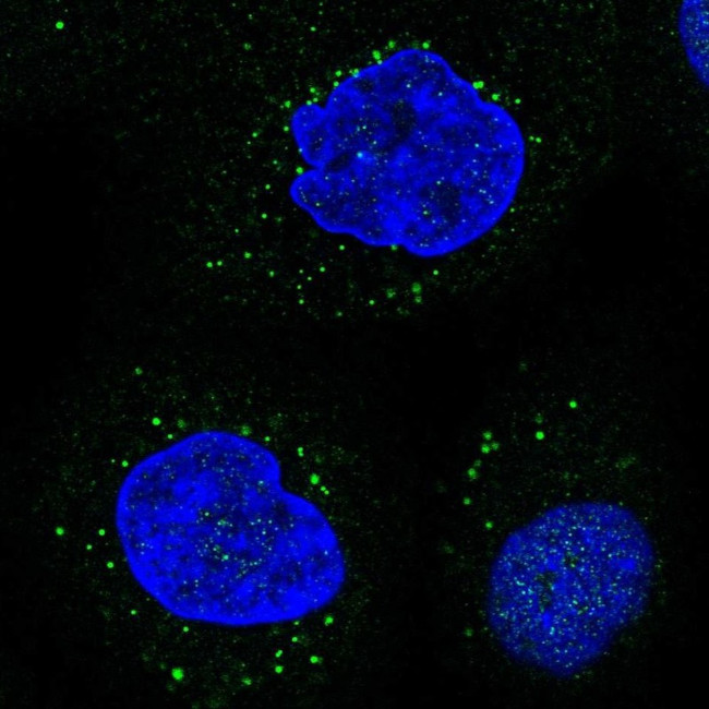 LIPA Antibody in Immunocytochemistry (ICC/IF)