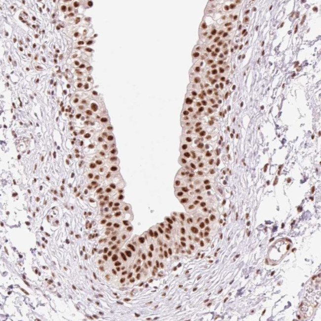PRDM11 Antibody in Immunohistochemistry (Paraffin) (IHC (P))