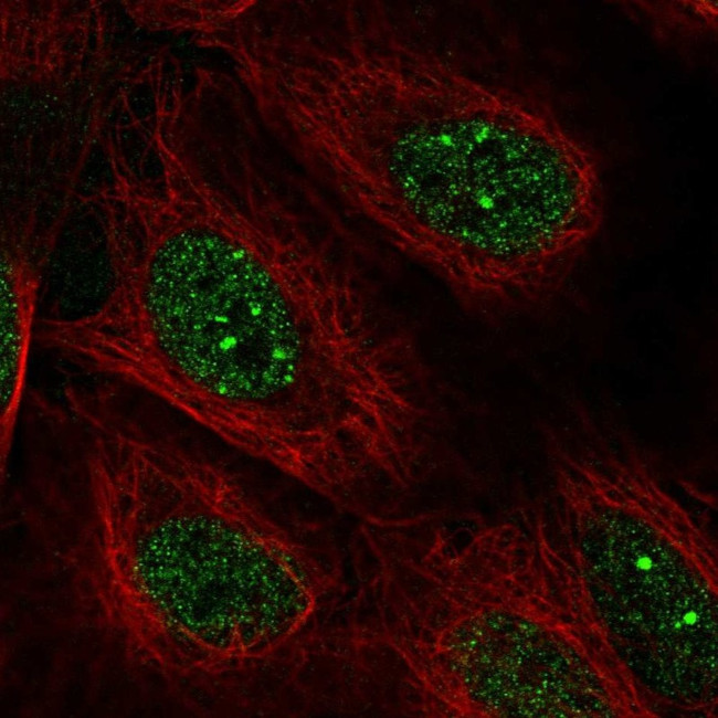 POLK Antibody in Immunocytochemistry (ICC/IF)