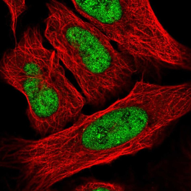 FOXR2 Antibody in Immunocytochemistry (ICC/IF)