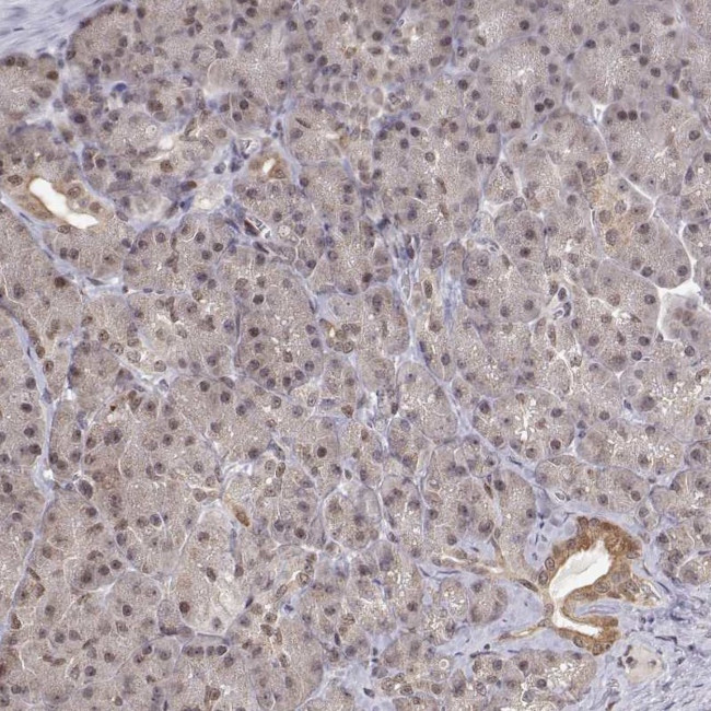 BRCA1 Antibody in Immunohistochemistry (Paraffin) (IHC (P))