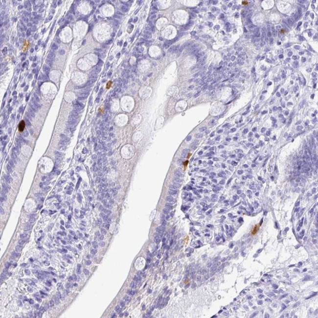 PRAMEF19 Antibody in Immunohistochemistry (Paraffin) (IHC (P))