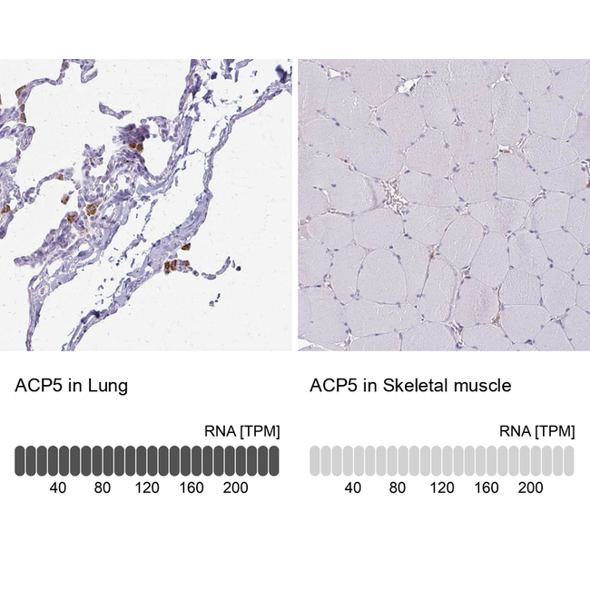 Tartrate Resistant Acid Phosphatase Antibody in Immunohistochemistry (Paraffin) (IHC (P))