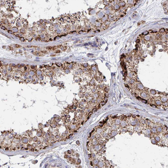 PEX3 Antibody in Immunohistochemistry (Paraffin) (IHC (P))